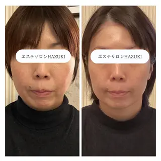 たるみ改善小顔エステ 堀葉月のその他イメージ