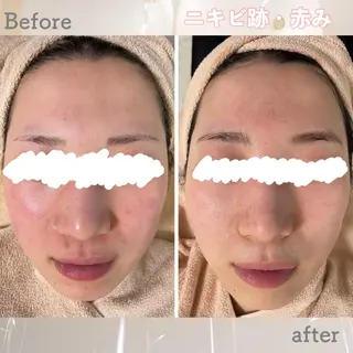 ショート カラー パーマ ヘアアレンジ メンズ キッズ ネイル マツエク・マツパ アイブロウ ニキビ&跡改善サロン オーナー光木のエステ・リラクイメージ