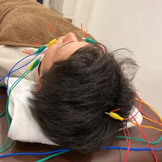 美容鍼灸Solana所属・肌質改善×美容鍼 ゆいのエステ・リラクイメージ