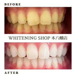 メンズ ホワイトニング ショップ本八幡店のエステ・リラクイメージ