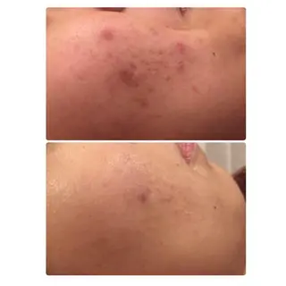 西区九条エステ MITUREIサロンのエステ・リラクイメージ