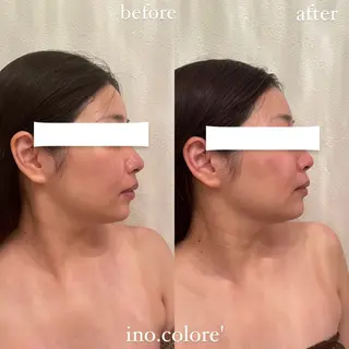 エステサロンino.colore'所属・小顔サロン ino.coloreのエステ・リラクイメージ