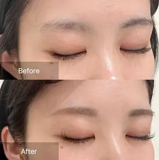 アイブロウ for woman所属・森 美優のエステ・リラクイメージ