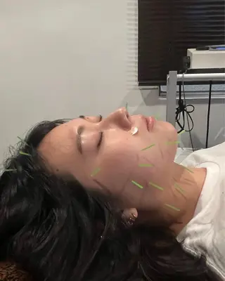 メンズ 美容鍼灸サロン LOMIHARIのエステ・リラクイメージ