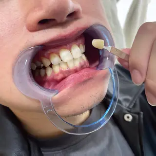 歯のセルフホワイトニング専門店GLOW（グロウ）所属・東区香椎歯のセルフホ ワイトニングGLOWのその他イメージ