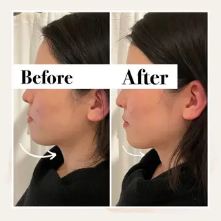 12Dハイフ💗 最強小顔のエステ・リラクイメージ