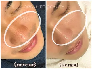 メンズ OPS×LIFE BEAUTY所属・OPS×LIFE BEAUTY/maiのエステ・リラクイメージ