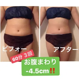 小尻・太もも痩せる エステルナボーテのエステ・リラクイメージ