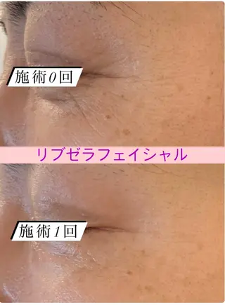 Private Salon Prunelle所属・プライベートサロン プリュネルのエステ・リラクイメージ