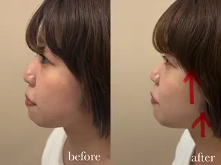 ENNE🦩小顔整体 師🌿 HINAKOのエステ・リラクイメージ