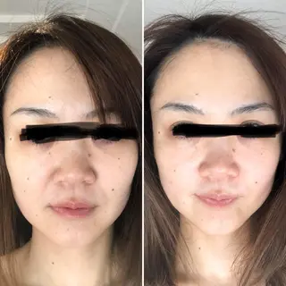 Meetite 小林のエステ・リラクイメージ