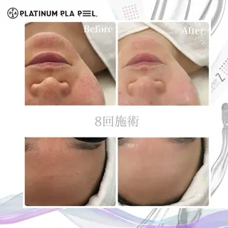 Liam《美肌管理/ 3D小顔/脂肪ケア》のその他イメージ