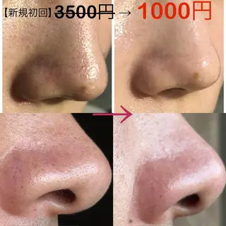 SHINY エステサロンのその他イメージ