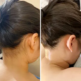 うなじ脱毛/美肌脱毛 LABELのエステ・リラクイメージ