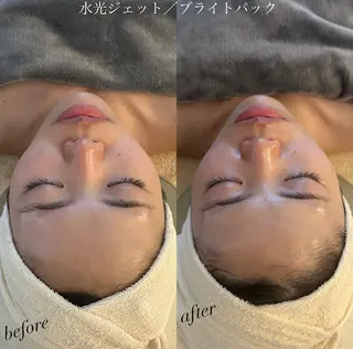 うなじ脱毛/美肌脱毛 LABELのエステ・リラクイメージ