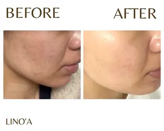 Salon💫 Lino'a柏店のエステ・リラクイメージ