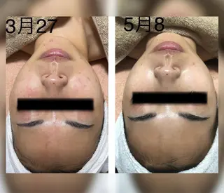 B.glossy所属・ビューティーサロン B.glossyのネイルデザイン