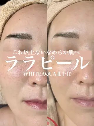 WHITE AQUA 北千住店のエステ・リラクイメージ