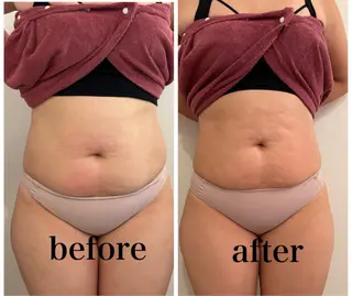 腸活サポート みなみののエステ・リラクイメージ