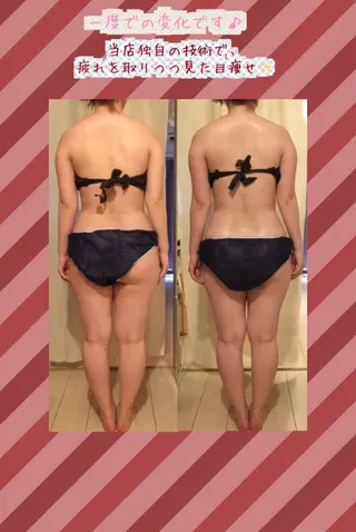 ショート カラー パーマ ヘアアレンジ メンズ キッズ ネイル マツエク・マツパ 強圧オールハンド痩身&黄土よもぎ蒸しプライベートサロンClematis池袋所属・強圧オールハンド痩身 片野のエステ・リラクイメージ