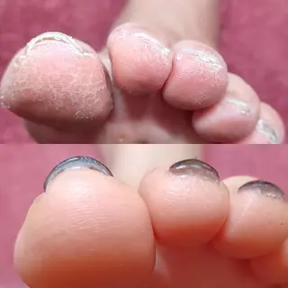 Micky nail chikushinoのネイルデザイン