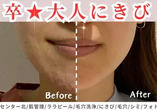 sii センター北 AIのエステ・リラクイメージ