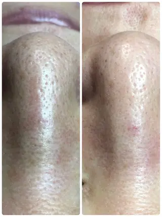 private salon Dea_maris シュガーリング&パーソナルボディケア所属・シミ改善・韓国肌管理 ボディメイク痩身のその他イメージ