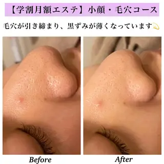 Bellesthe (ベルエステ)のエステ・リラクイメージ