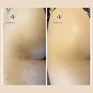 ニキビ改善専門店 d'Albaのエステ・リラクイメージ