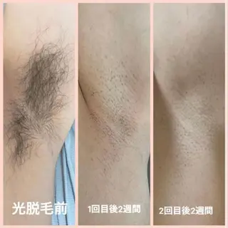 Beauty   Salon  Adiy所属・Adiy ikumiのエステ・リラクイメージ