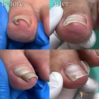 ネイル 東京巻き爪アカデミー所属・東京巻き爪 アカデミーのエステ・リラクイメージ