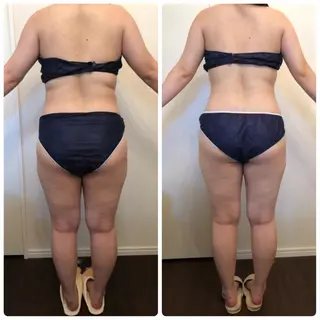 FLEUR大阪・美容 整体・痩身・小顔のエステ・リラクイメージ