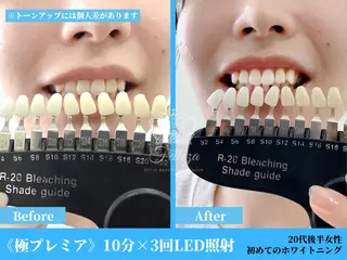 有人型セルフサロン 脱毛/痩身/美顔のその他イメージ