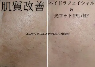 ユニセックスエステサロンUniclear所属・男女エステ ユニクリアのエステ・リラクイメージ