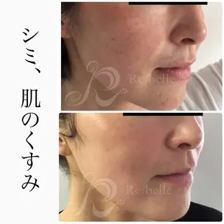 ハーブピーリング専門 BIOEL横浜のエステ・リラクイメージ