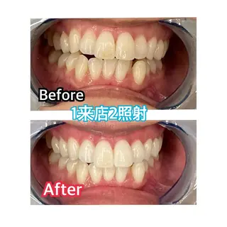 プラチナムビューティー柏所属・【歯科提携】柏ホワイ トニングスタイルのその他イメージ