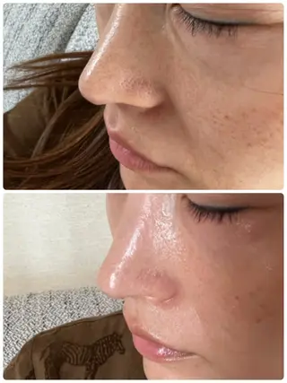 FLEUR大阪・整体 ・ハイフ・痩身・小顔のエステ・リラクイメージ