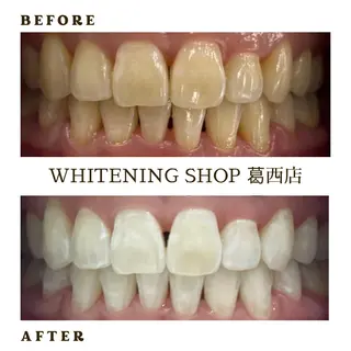 メンズ ホワイトニング ショップ葛西店のその他イメージ