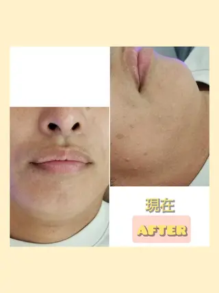 メンズ salonde ReGodのエステ・リラクイメージ