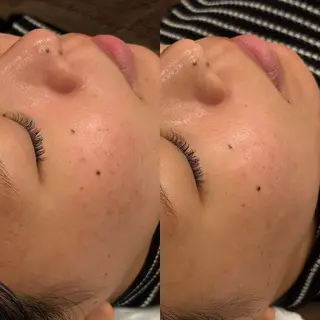 Hari Lounge恵比寿所属・chika🦋 ハリラウンジ恵比寿のエステ・リラクイメージ