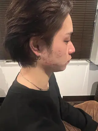 メンズ 美容鍼灸サロン LOMIHARIのエステ・リラクイメージ