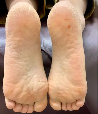 ネイル ネイルサロンnico 安田のネイルデザイン