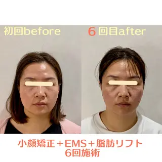 最速小顔・肌質管理 ❣️エスポワールのエステ・リラクイメージ