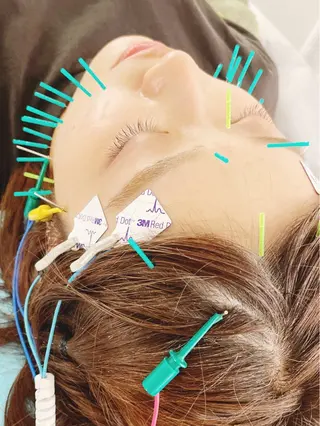 小顔美容鍼専門サロン 渋谷YZのエステ・リラクイメージ