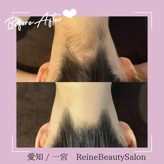 Reine BeautySalon所属・毛穴/シミ肝斑/脱毛 横山梨里のエステ・リラクイメージ
