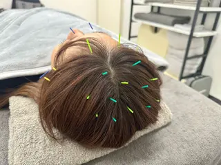 美容鍼×小顔矯正 ×美容整体 浜川泰仁のエステ・リラクイメージ