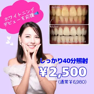 ホワイトニング ショップ多摩店のその他イメージ