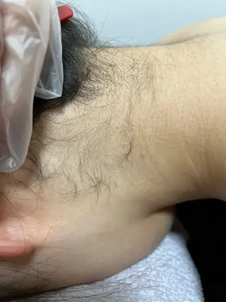 メンズ キッズ 脱毛SALON RaYNiCKのエステ・リラクイメージ