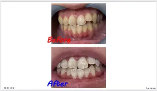 セルフホワイトニングサロン　ラヴィアン所属・ホワイトニングサロン La vie enのその他イメージ