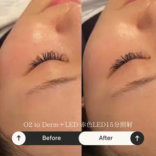 crescent所属・【韓国肌管理・脱毛】 クレセントのエステ・リラクイメージ